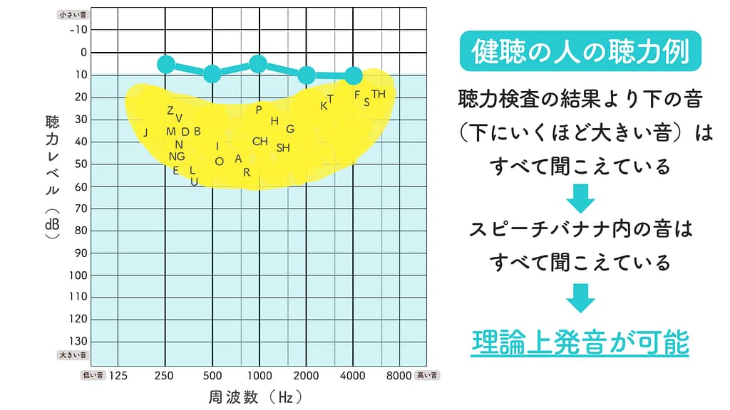健聴の人の聴力図