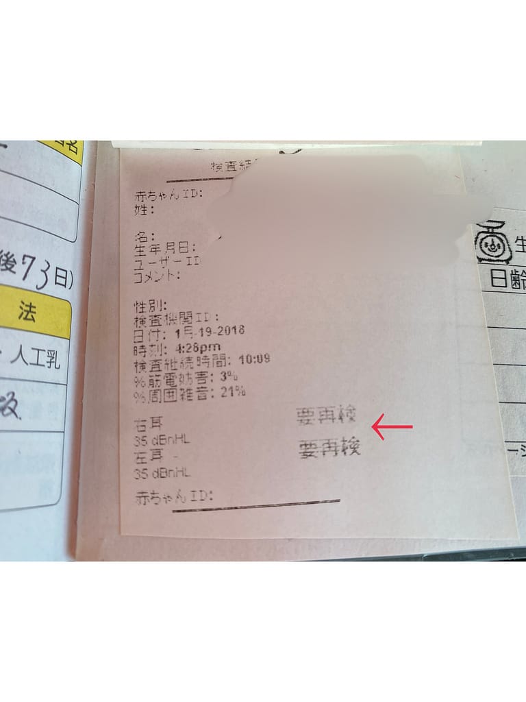 新生児聴覚スクリーニング検査の結果用紙